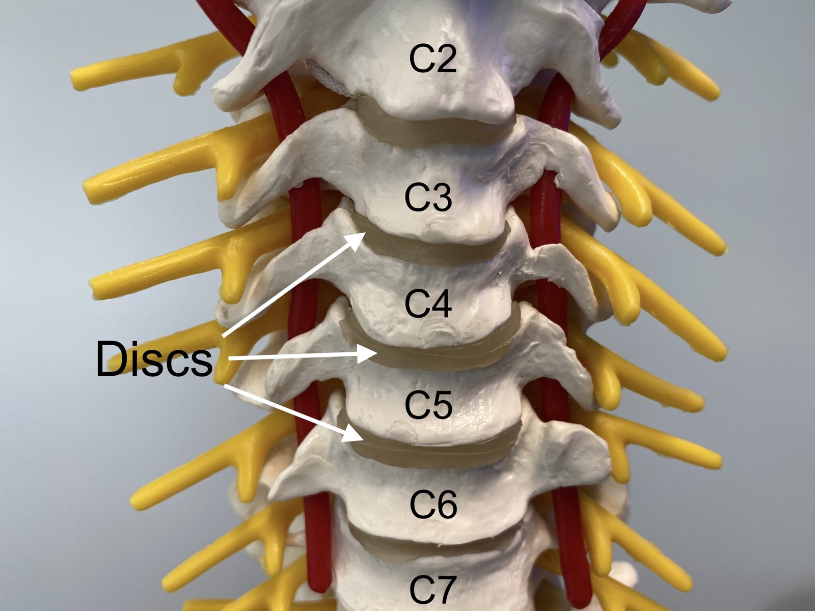 Illustration of the cervical spine from the front, showing the vertebrae from C2 to C7, the discs between them, and the nerve roots